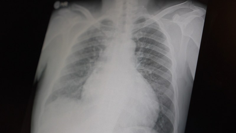 Samsun'da uzman isim açıkladı: Gençler büyük tehlikede