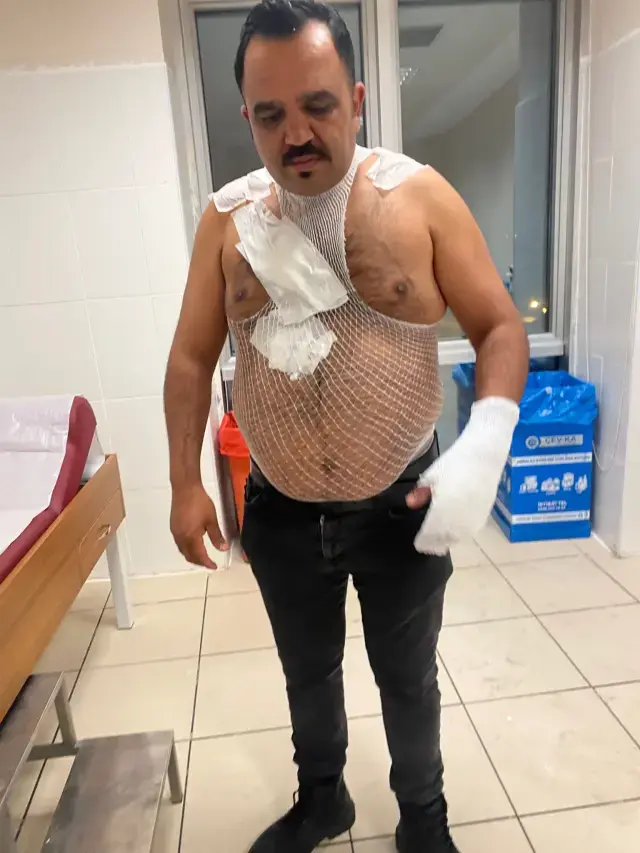 Deney Yapmak Isterken Hayatinin Hatasini