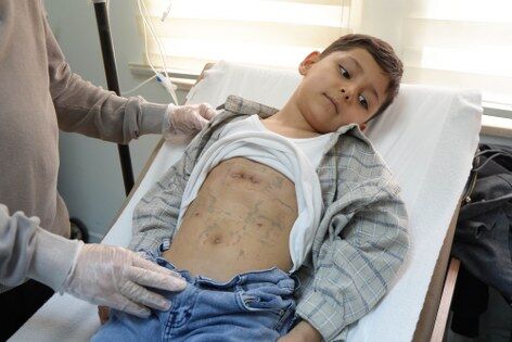 50 binde bir görülüyor! Samsun'da bir ilk 