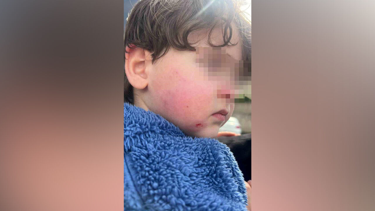 Kreşe bıraktığı çocuğunu darp edilmiş halde aldı!