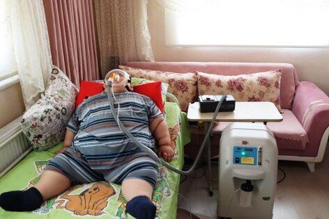 samsun haber: 5 yaşında 90 kiloydu! Samsun'da Yağız'ın mucize değişimi
