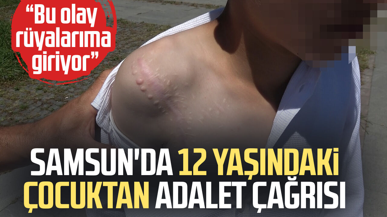 🐕 Samsun'da 12 Yaşındaki Çocuktan Adalet Çağrısı! 4