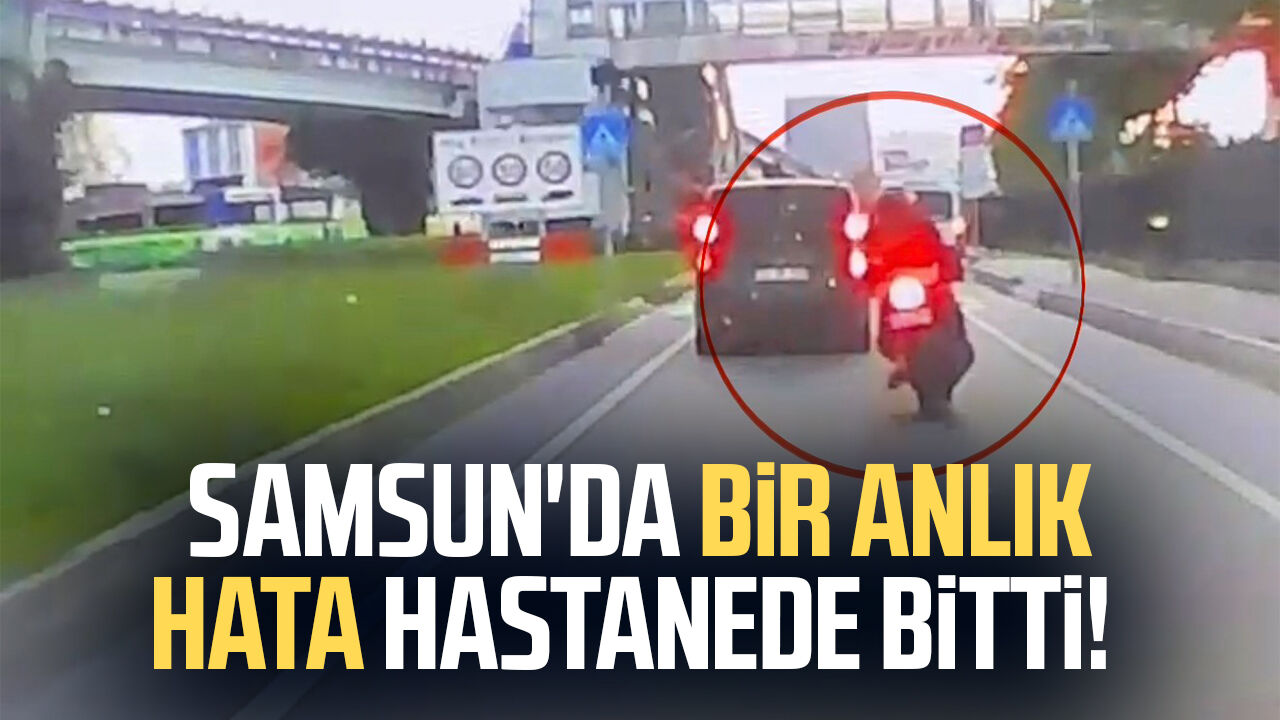 Samsun'da Bir Anlık Hata Hastanede Bitti! 44