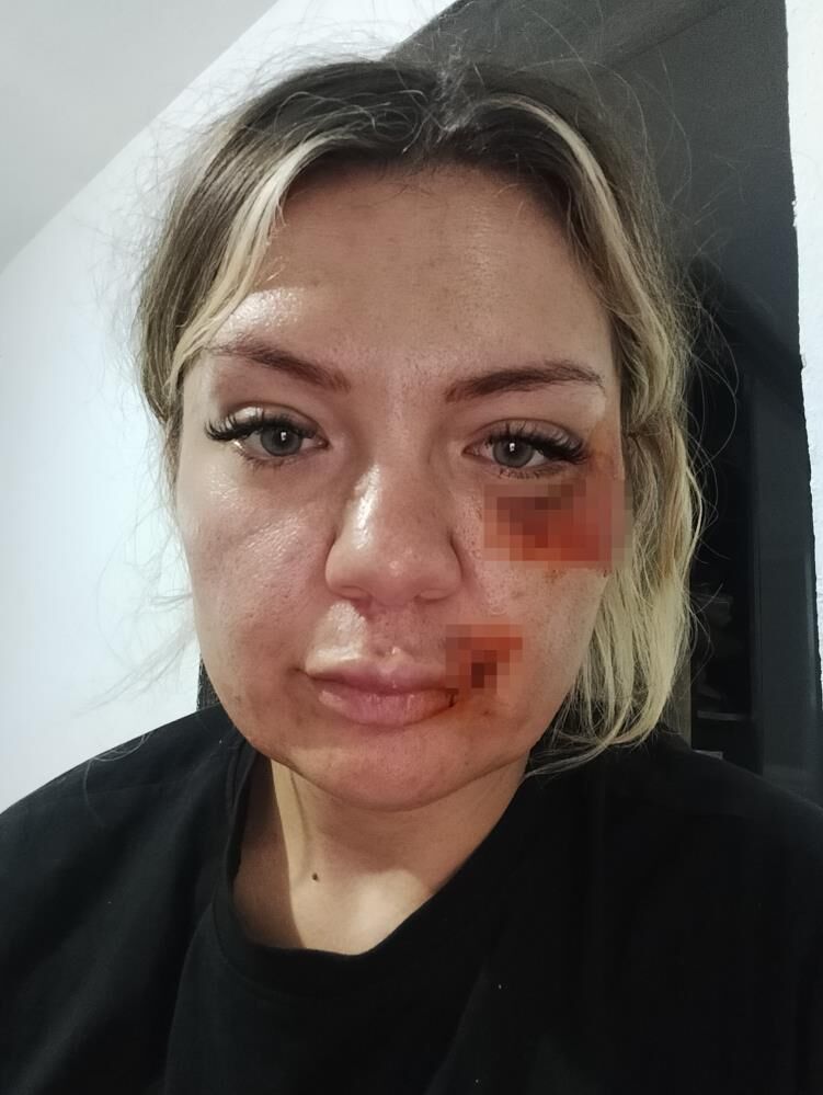 Samsun detayı ortaya çıktı! Cezaevinden izinli çıkıp dehşet saçtı