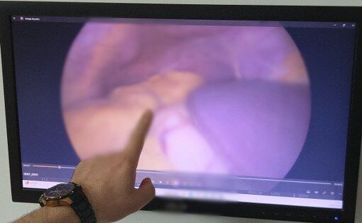 samsun haber: Samsun’da doktorları şaşırtan vaka! Organları ters çıktı