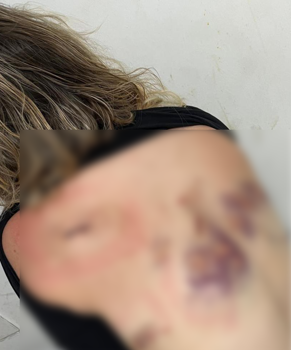 Samsun detayı ortaya çıktı! Cezaevinden izinli çıkıp dehşet saçtı