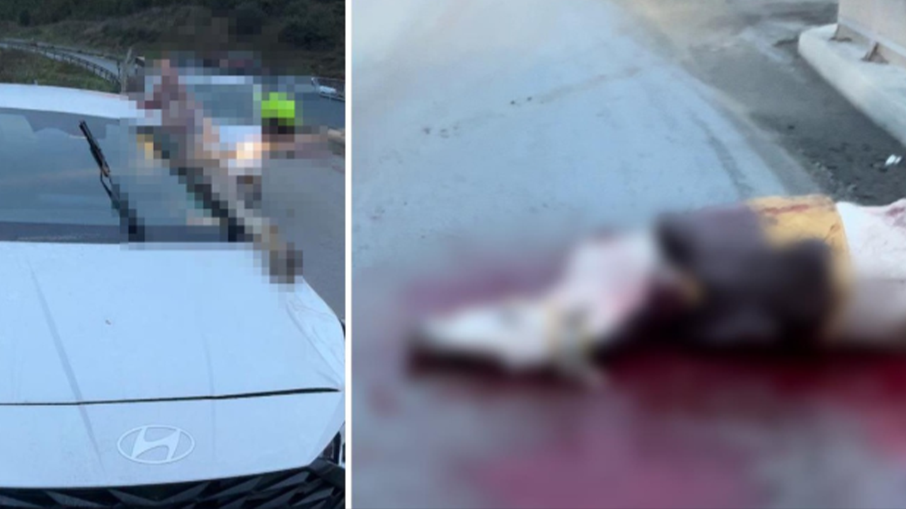 Korkunç kazada akılalmaz olay! Kopan bacağı araca saplandı